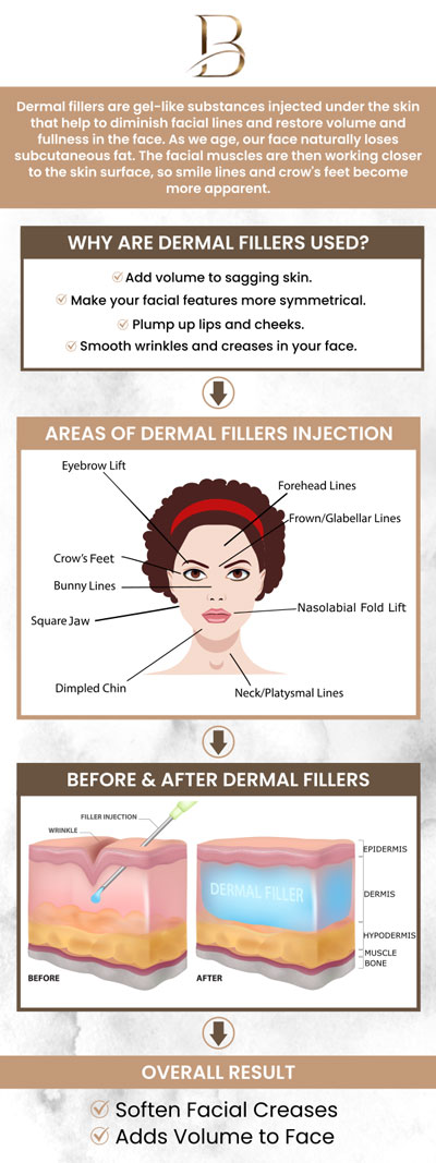 Dermal fillers are a non-surgical solution to restore volume, smooth wrinkles, and enhance facial contours. This treatment helps reduce the appearance of fine lines, plump hollow areas, and creates a more youthful, refreshed look. Dr. Marlin, MD, and Dr. Ngu Thien Nguyen, MD, offer a quick and effective way to rejuvenate your appearance without the need for surgery. For more information, contact us or request an appointment online. We are located at 123 ABC Ave Suite A, Los Altos, CA 123456. Dermal fillers are a non-surgical solution to restore volume, smooth wrinkles, and enhance facial contours. This treatment helps reduce the appearance of fine lines, plump hollow areas, and creates a more youthful, refreshed look. Dr. Marlin, MD, and Dr. Ngu Thien Nguyen, MD, offer a quick and effective way to rejuvenate your appearance without the need for surgery. For more information, contact us or request an appointment online. We are located at 123 ABC Ave Suite A, Los Altos, CA 123456.