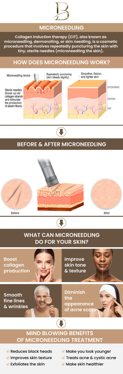 Dermal fillers are a non-surgical solution to restore volume, smooth wrinkles, and enhance facial contours. This treatment helps reduce the appearance of fine lines, plump hollow areas, and creates a more youthful, refreshed look. Dr. Marlin, MD, and Dr. Ngu Thien Nguyen, MD, offer a quick and effective way to rejuvenate your appearance without the need for surgery. For more information, contact us or request an appointment online. We are located at 123 ABC Ave Suite A, Los Altos, CA 123456. Microneedling with PRP is an advanced skincare treatment that combines the power of microneedling with the healing properties of Platelet-Rich Plasma (PRP). This treatment helps reduce fine lines, acne scars, and uneven skin tone, leaving the skin smoother, firmer, and more radiant with minimal downtime. Visit Dr. Marlin, MD, and Dr. Ngu Thien Nguyen, MD, to experience the benefits of Microneedling with PRP and achieve smoother, rejuvenated skin. For more information, contact us or request an appointment online. We are located at 123 ABC Ave Suite A, Los Altos, CA 123456.